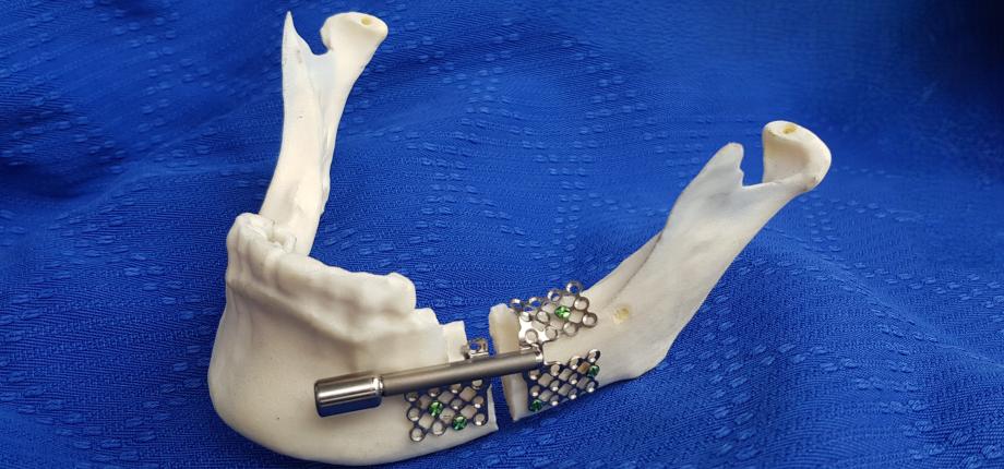 Mechanics and maxillofacial surgery, the winning duo